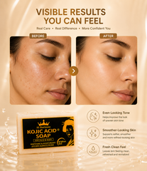 Kojic Acid Soap for Face & Body – 3 Pack Brightening & Moisturizing Soap Bars | Helps Improve the Appearance of Dark Spots, Blemishes & Uneven Skin Tone | Deep Cleansing Daily Skincare Bar