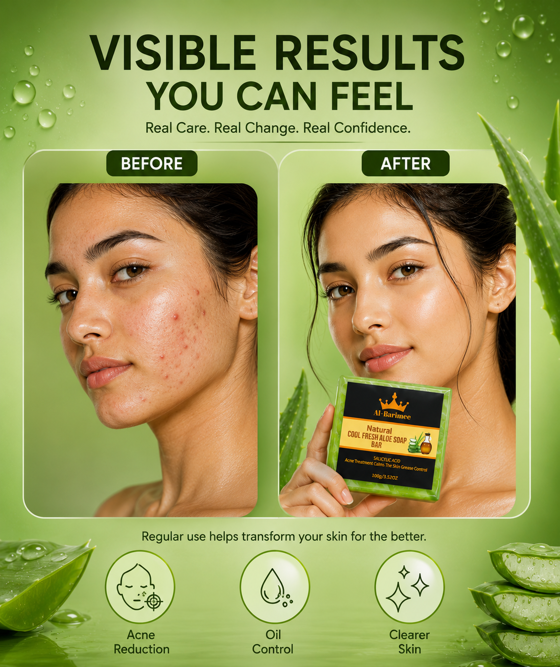 Natural Aloe Vera Soap Bar for Face & Body – 3 Pack | Cool Fresh Cleansing Soap with Tea Tree Oil & Salicylic Acid | Helps Cleanse Pores, Control Excess Oil & Support Acne-Prone Skin