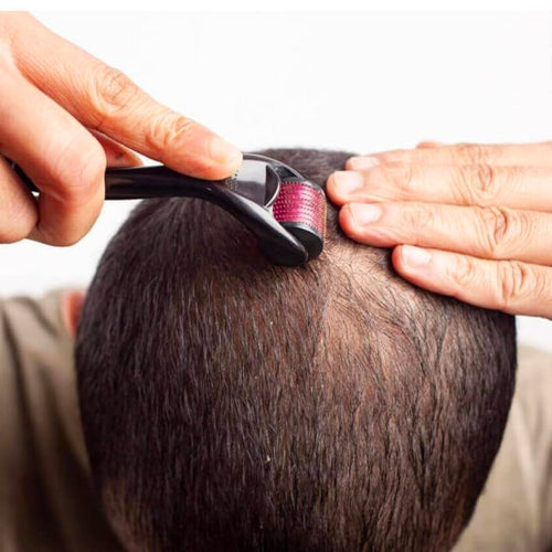 Derma Roller