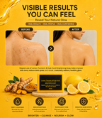 Lemon Turmeric & Kojic Acid Brightening Soap Bar for Face & Body – 3 Pack