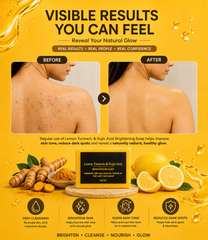 Lemon Turmeric & Kojic Acid Brightening Soap – 3-Pack | Deep Cleansing Bar for Face & Body | Helps Brighten Skin, Even Skin Tone & Reduce the Appearance of Dark Spots | 3 × 3.52 oz